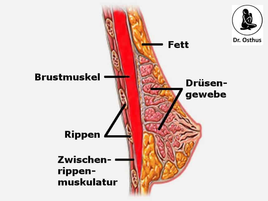 Anatomie der Brust zur Bestimmung der Implantatlage für die Brust-OP in Böblingen bei Stuttgart.